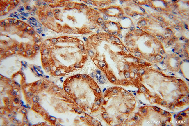 SCUBE3 Antibody in Immunohistochemistry (Paraffin) (IHC (P))