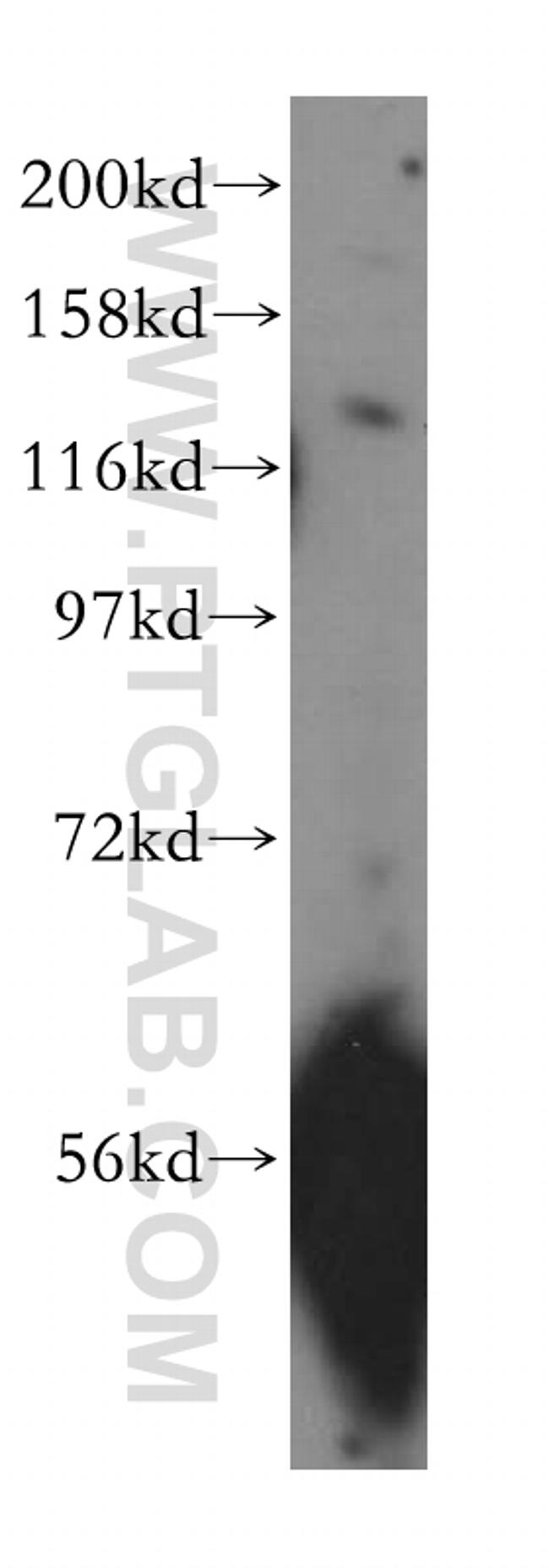 SCUBE3 Antibody in Western Blot (WB)