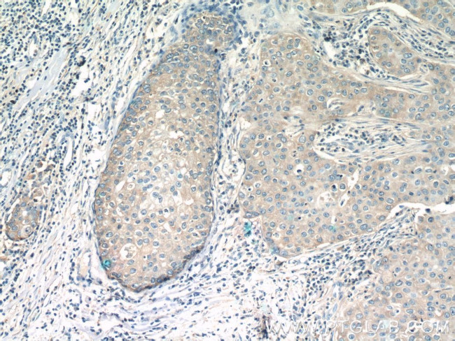 RAB11FIP1 Antibody in Immunohistochemistry (Paraffin) (IHC (P))