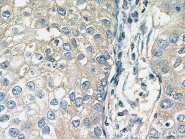 RAB11FIP1 Antibody in Immunohistochemistry (Paraffin) (IHC (P))