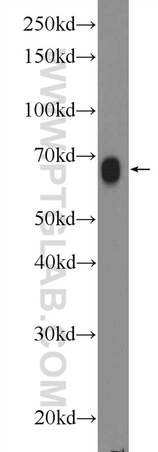 RAB11FIP1 Antibody in Western Blot (WB)