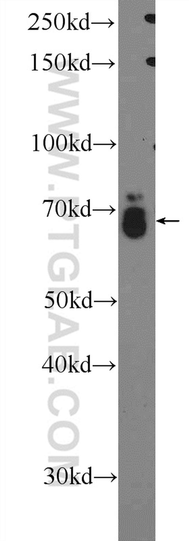 RAB11FIP1 Antibody in Western Blot (WB)