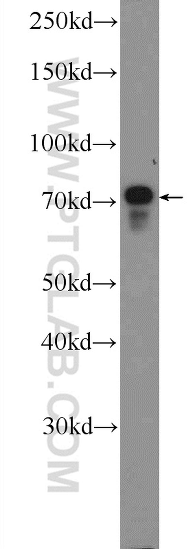 RAB11FIP1 Antibody in Western Blot (WB)