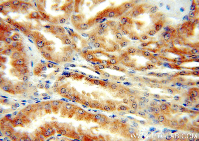 DcR2 Antibody in Immunohistochemistry (Paraffin) (IHC (P))