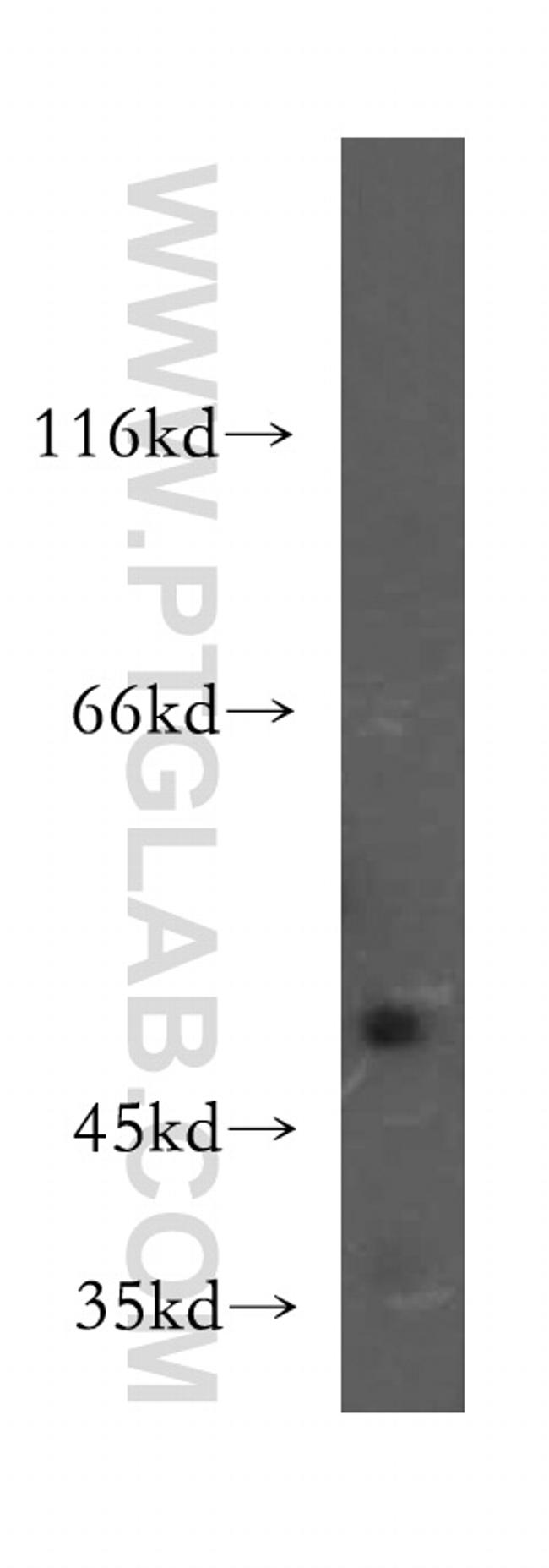 DcR2 Antibody in Western Blot (WB)