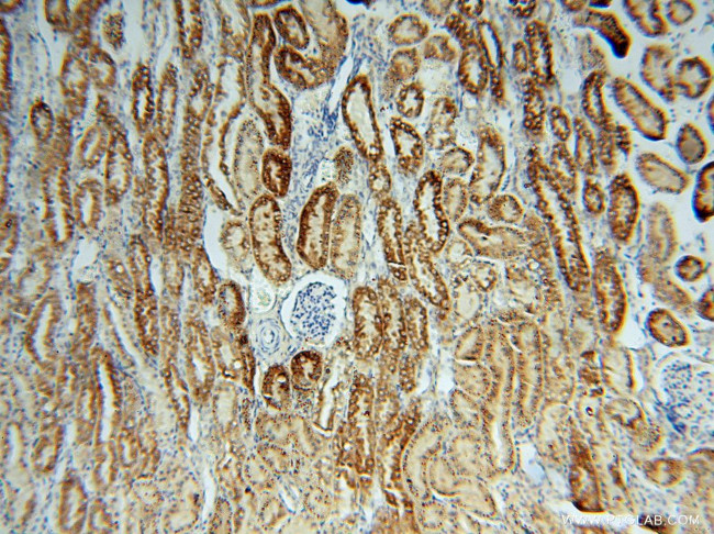 THEM2 Antibody in Immunohistochemistry (Paraffin) (IHC (P))