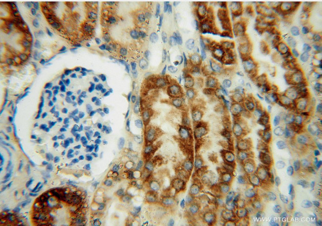 THEM2 Antibody in Immunohistochemistry (Paraffin) (IHC (P))