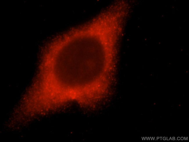 LACTB2 Antibody in Immunocytochemistry (ICC/IF)