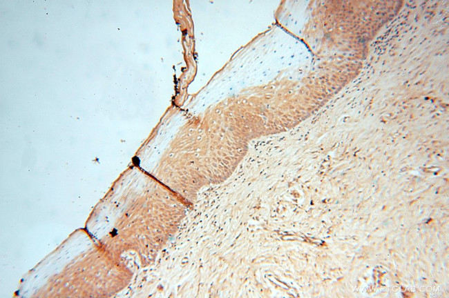 LACTB2 Antibody in Immunohistochemistry (Paraffin) (IHC (P))