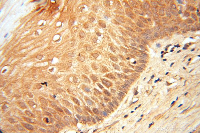 LACTB2 Antibody in Immunohistochemistry (Paraffin) (IHC (P))