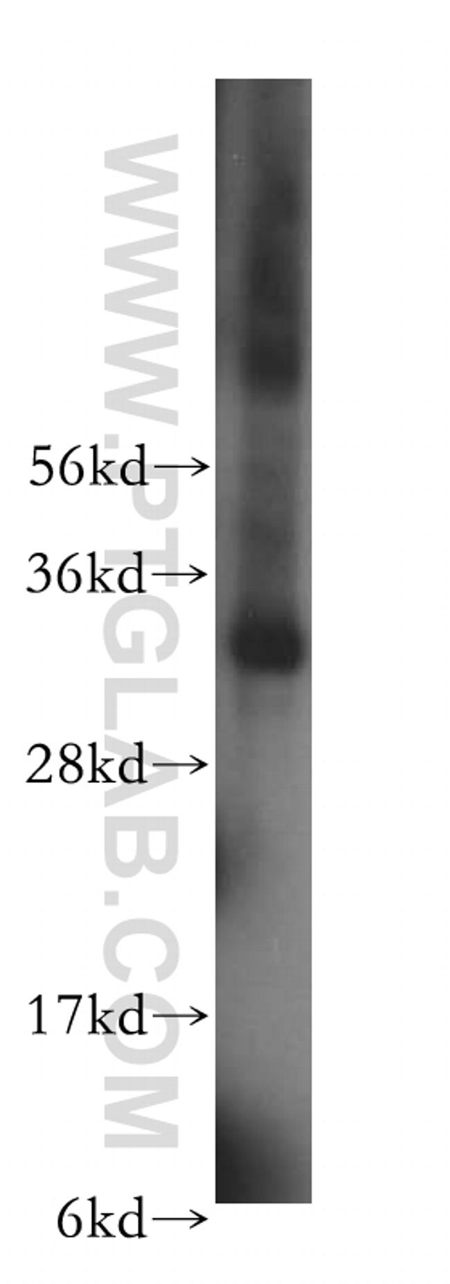 LACTB2 Antibody in Western Blot (WB)