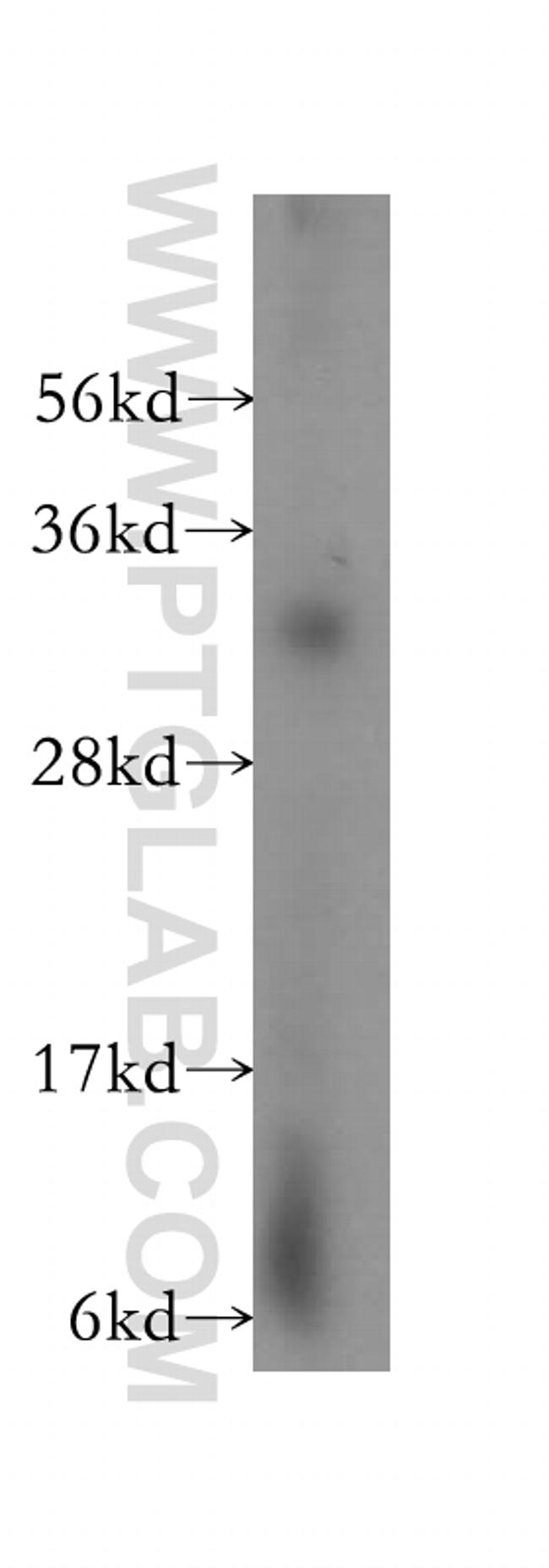 LACTB2 Antibody in Western Blot (WB)