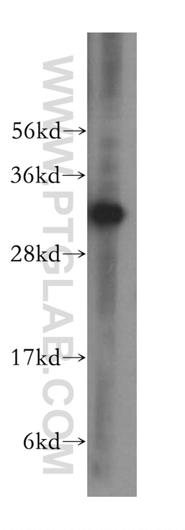 LACTB2 Antibody in Western Blot (WB)