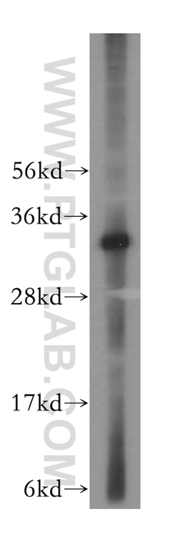 LACTB2 Antibody in Western Blot (WB)