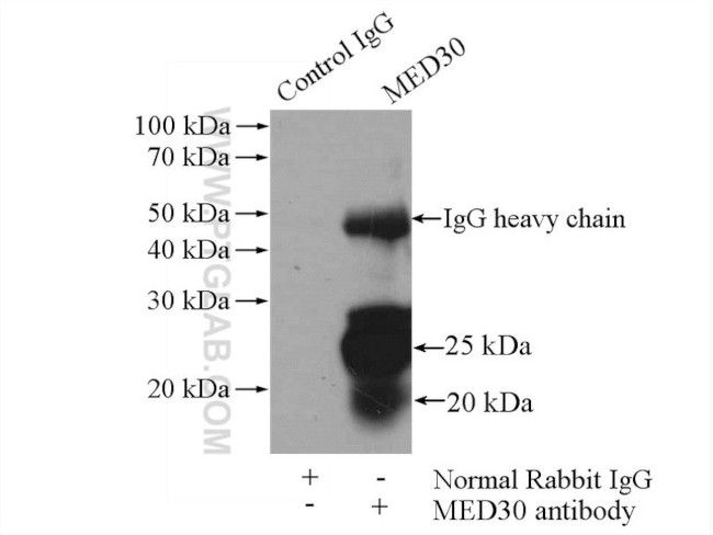 MED30 Antibody in Immunoprecipitation (IP)