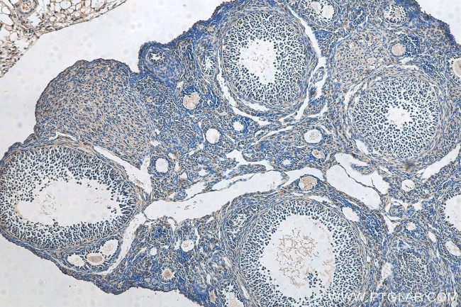 GLOD4 Antibody in Immunohistochemistry (Paraffin) (IHC (P))