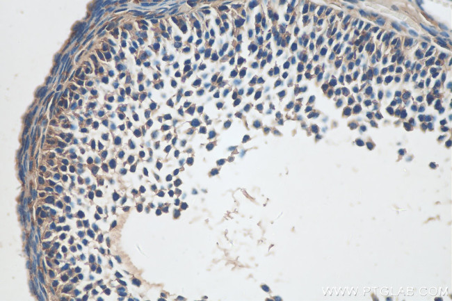 GLOD4 Antibody in Immunohistochemistry (Paraffin) (IHC (P))