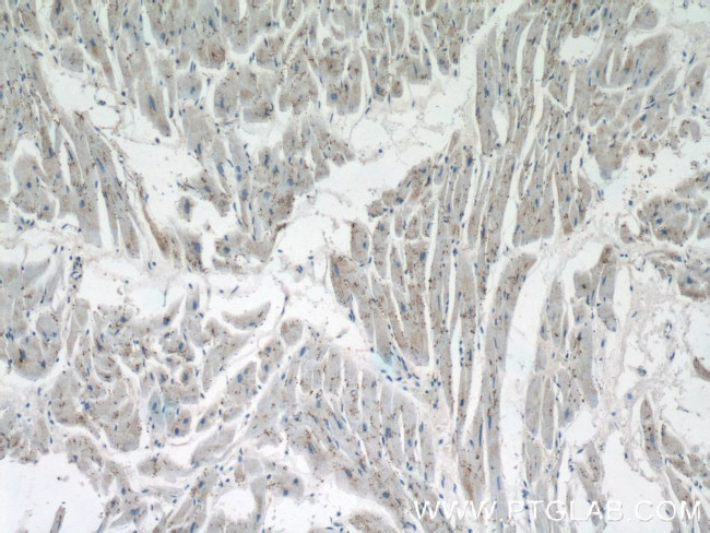 GLOD4 Antibody in Immunohistochemistry (Paraffin) (IHC (P))