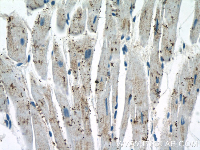 GLOD4 Antibody in Immunohistochemistry (Paraffin) (IHC (P))