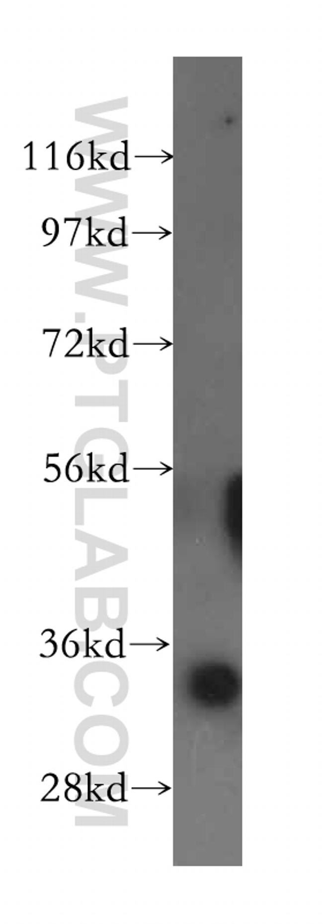 GLOD4 Antibody in Western Blot (WB)