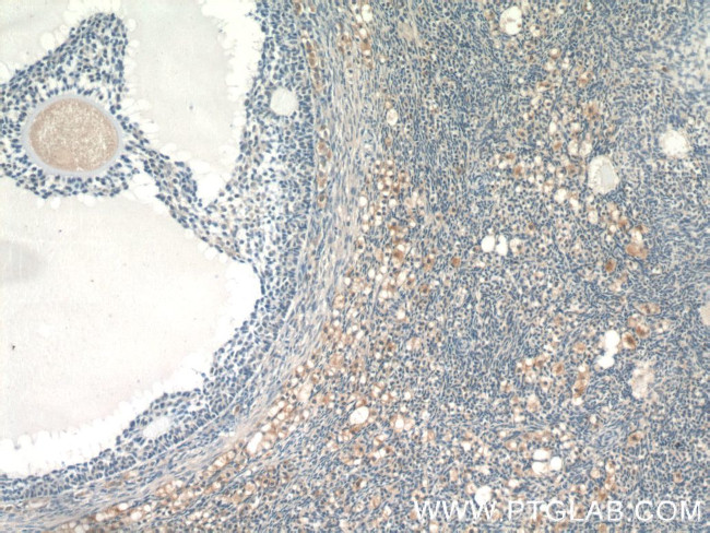 GLOD4 Antibody in Immunohistochemistry (Paraffin) (IHC (P))