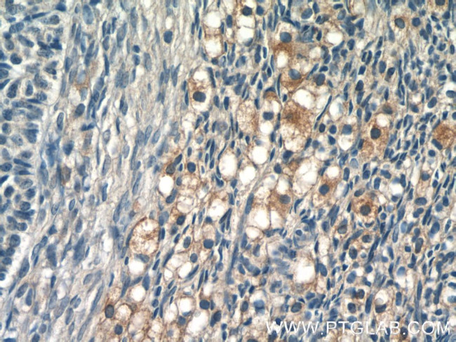 GLOD4 Antibody in Immunohistochemistry (Paraffin) (IHC (P))