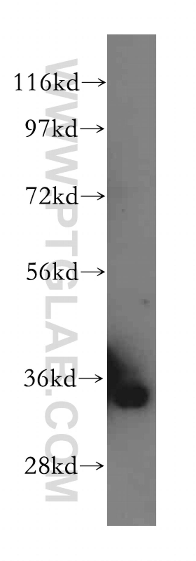 GLOD4 Antibody in Western Blot (WB)