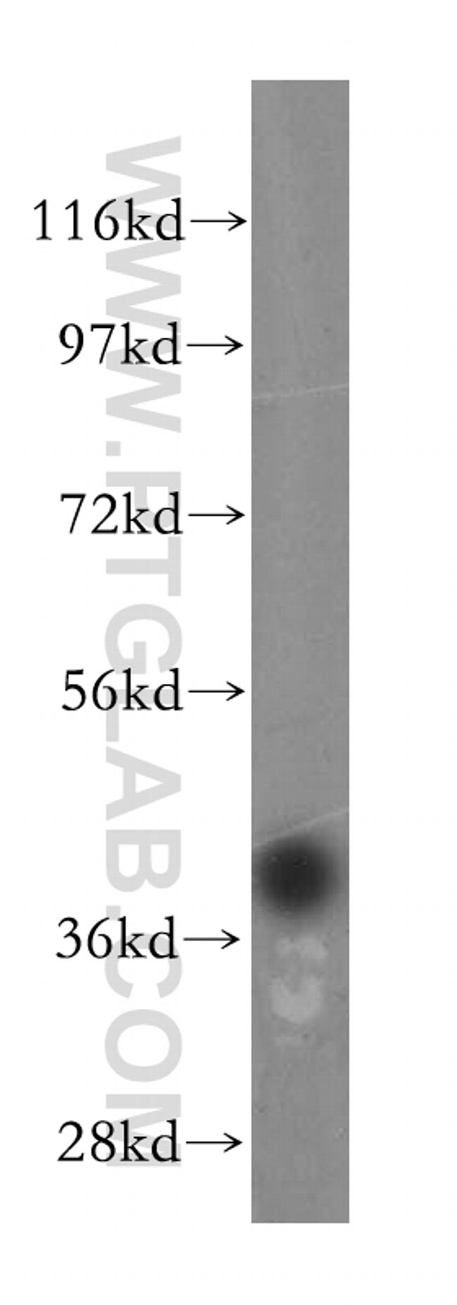 PRPSAP1 Antibody in Western Blot (WB)