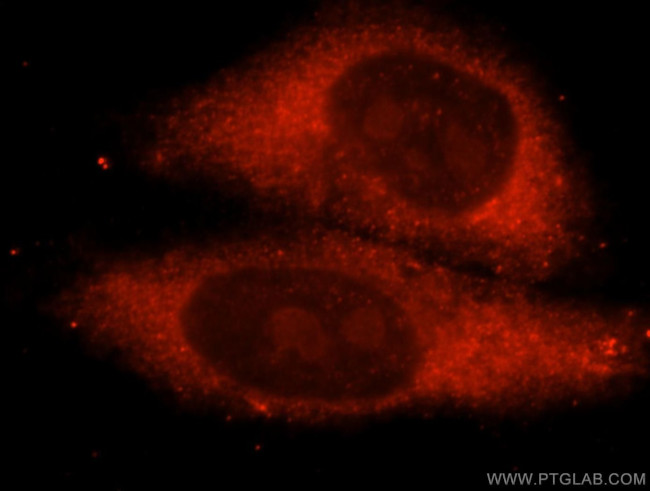 METTL5 Antibody in Immunocytochemistry (ICC/IF)