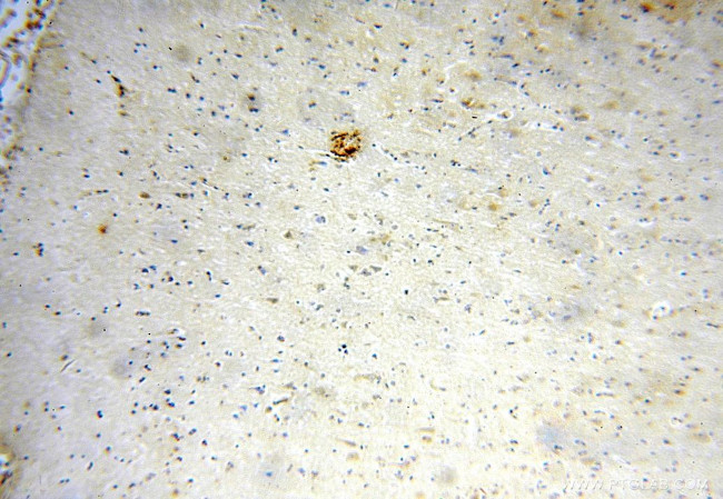 METTL5 Antibody in Immunohistochemistry (Paraffin) (IHC (P))