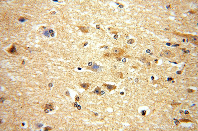 METTL5 Antibody in Immunohistochemistry (Paraffin) (IHC (P))