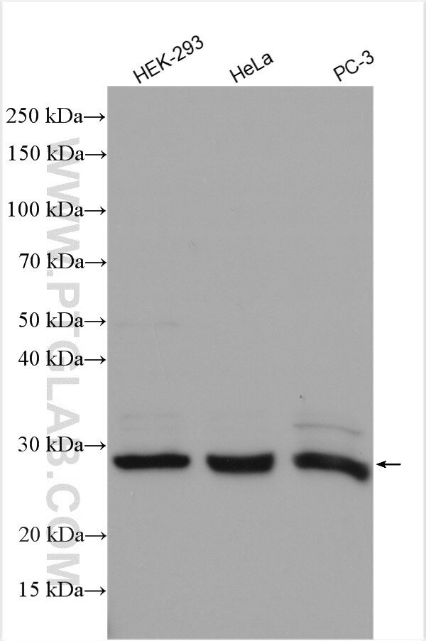 METTL5 Antibody in Western Blot (WB)