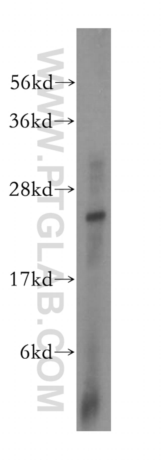 METTL5 Antibody in Western Blot (WB)