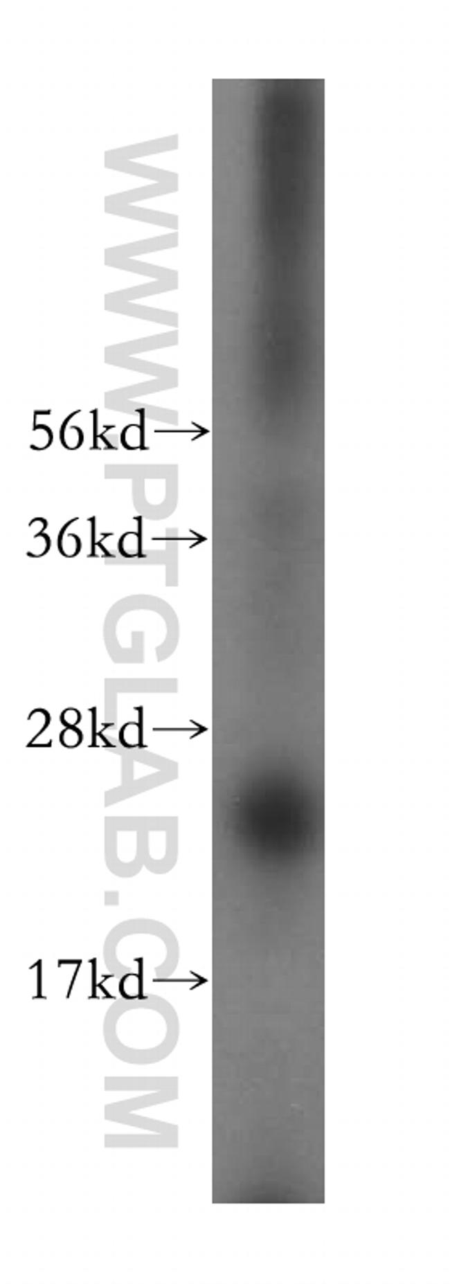 METTL5 Antibody in Western Blot (WB)