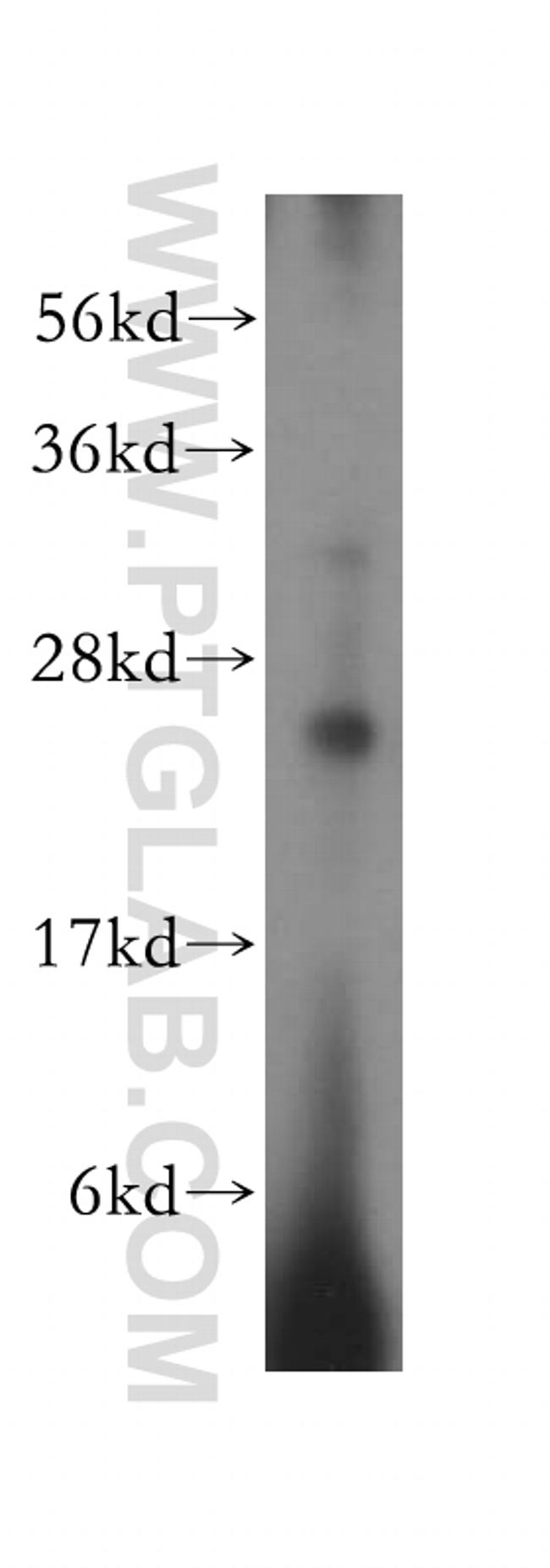 METTL5 Antibody in Western Blot (WB)