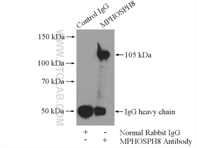 MPP8 Antibody in Immunoprecipitation (IP)