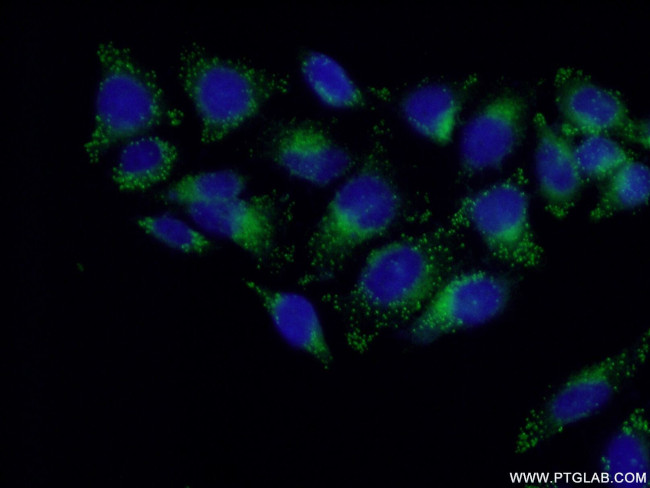 LITAF Antibody in Immunocytochemistry (ICC/IF)