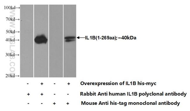 IL1 beta Antibody in Western Blot (WB)