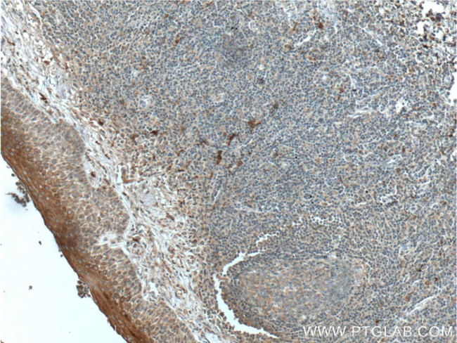 IL1 beta Antibody in Immunohistochemistry (Paraffin) (IHC (P))