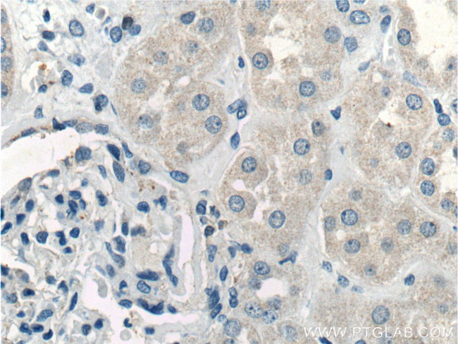 IL1 beta Antibody in Immunohistochemistry (Paraffin) (IHC (P))