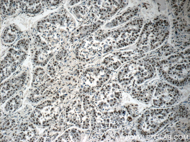 SNRPB Antibody in Immunohistochemistry (Paraffin) (IHC (P))