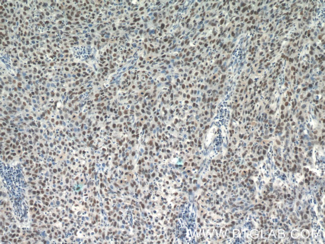 SNRPB Antibody in Immunohistochemistry (Paraffin) (IHC (P))