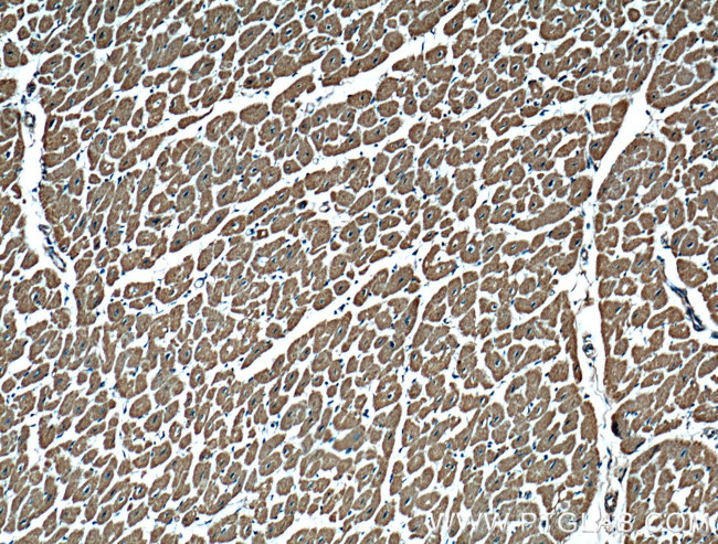 MAGED4 Antibody in Immunohistochemistry (Paraffin) (IHC (P))