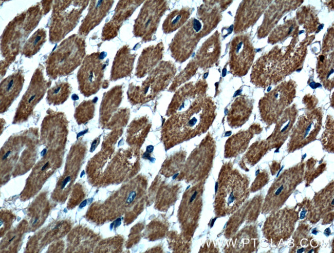 MAGED4 Antibody in Immunohistochemistry (Paraffin) (IHC (P))