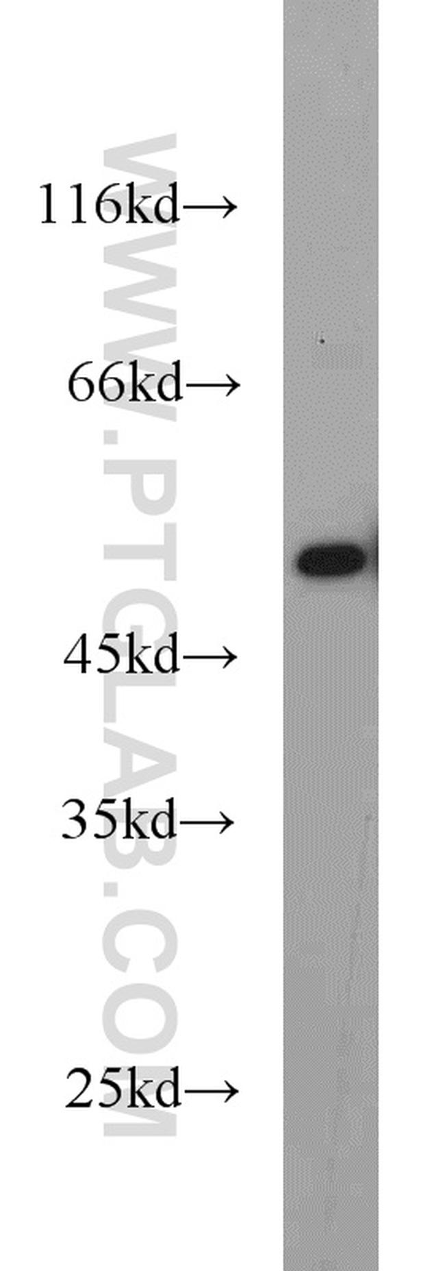 MAGED4 Antibody in Western Blot (WB)