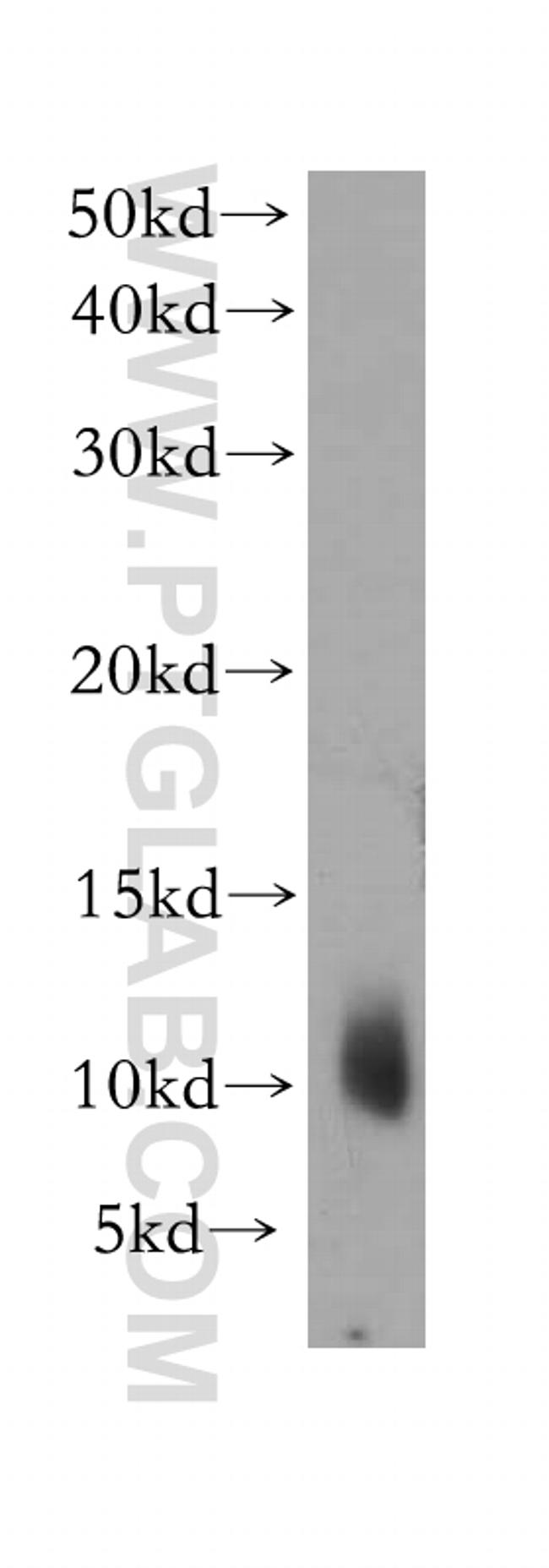 DYNLL2 Antibody in Western Blot (WB)