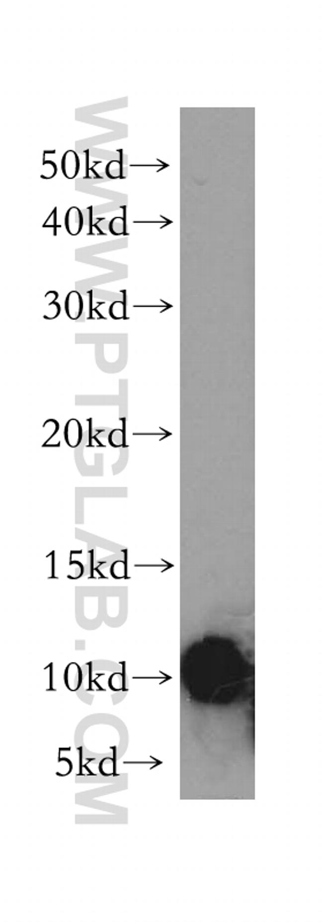 DYNLL2 Antibody in Western Blot (WB)