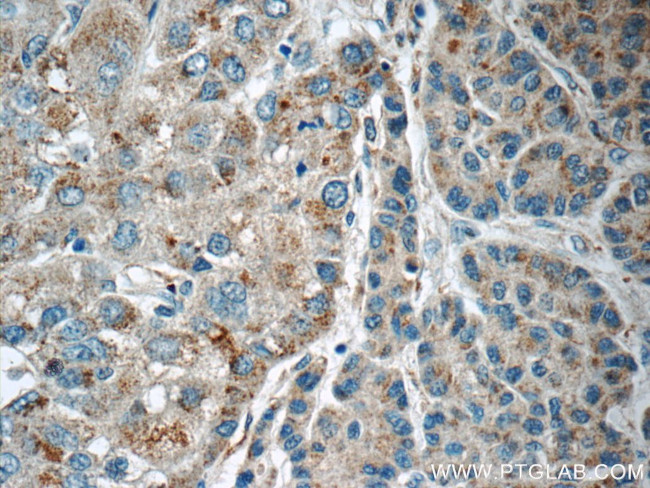 LMF1 Antibody in Immunohistochemistry (Paraffin) (IHC (P))