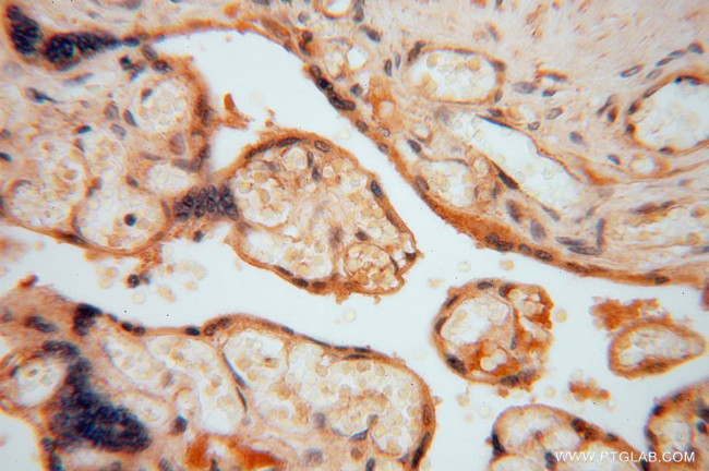 HIP1R Antibody in Immunohistochemistry (Paraffin) (IHC (P))