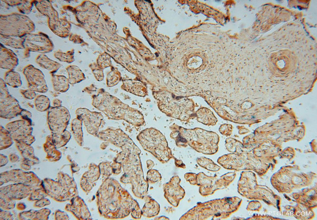 HIP1R Antibody in Immunohistochemistry (Paraffin) (IHC (P))